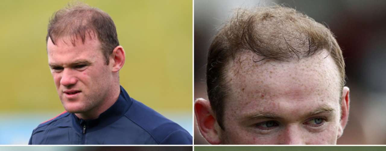 wayne-rooney-hair.jpg