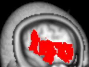 Los científicos analizaron la corteza cerebral prefrontal. Foto: BBC Mundo