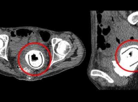 http://p1.trrsf.com/image/fget/cf/460/340/images.terra.com/2014/07/25/radiografiafoxnews.jpg