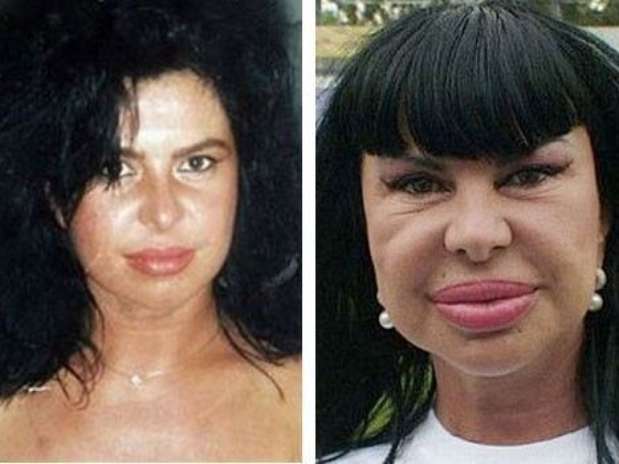 http://p1.trrsf.com/image/fget/cf/619/464/images.terra.com/2014/03/07/plastic-surgery-13.jpg